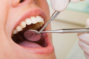 Immediate Dentures Immediate Dentures