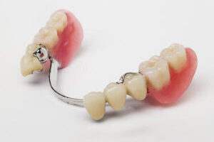 Partial Dentures Partial Dentures