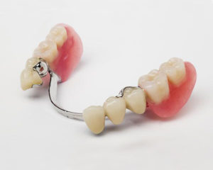 Partial Dentures